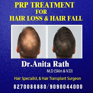 hair fall treatment clinic